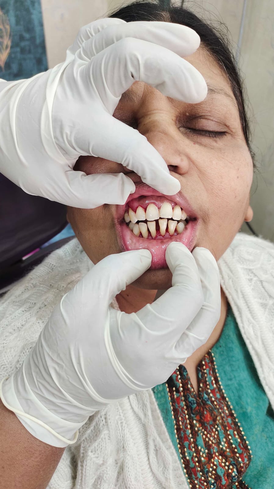 Patient 3 case photo after care